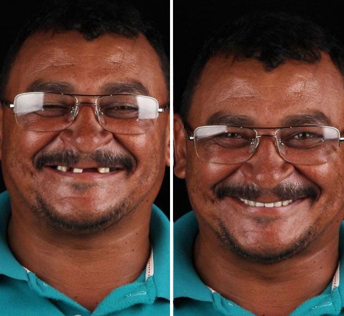 brazilian-dentist-travel-poor-people-teeth-fix-felipe-rossi-36-5db9502187fb1__700.jpg