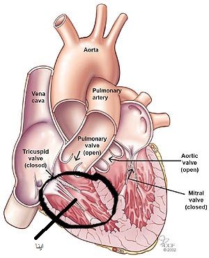 inside-heart-3.jpg