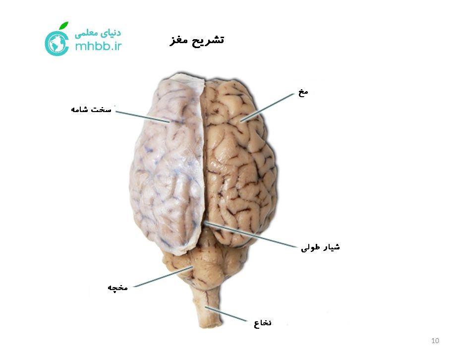 BrainAnatomy–SheepBrain.jpg