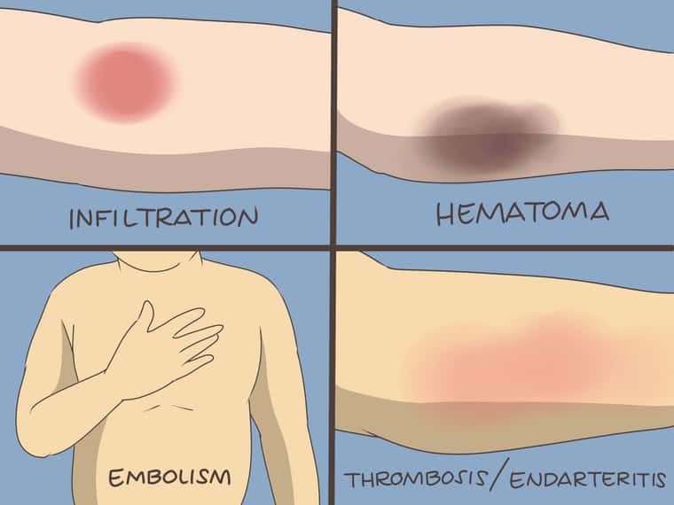 Insert-an-IV-Step-20-Version-2.jpg